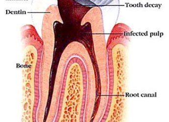 Dentist Course in Mumbai – Unlocking Excellence in Dentistry with Integratedendo