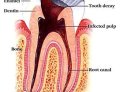 Dentist Course in Mumbai – Unlocking Excellence in Dentistry with Integratedendo